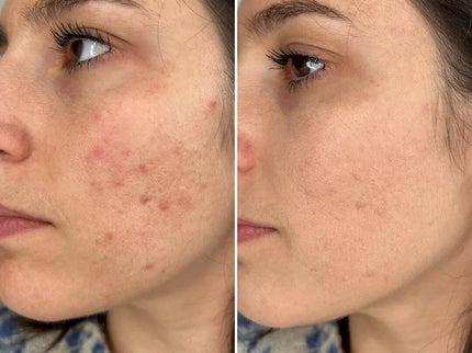 Nouveauté ! BB Crème Flawless – Soin & Maquillage Anti-Imperfections 50ml