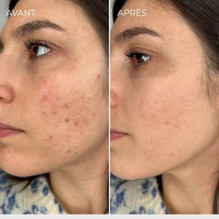 Nouveauté ! BB Crème Flawless – Soin & Maquillage Anti-Imperfections 50ml