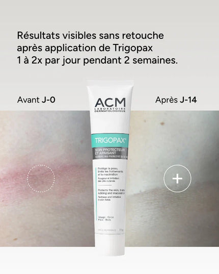 ACM TRIGOPAX Soin Protecteur Apaisant - 75g