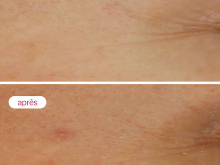 NOVEXPERT SÉRUM BOOSTER à l'Acide Hyaluronique - 30ml