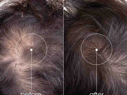 Nouveauté ! KLORANE SÉRUM Fortifiant Anti-Chute Réactionnelle - 100ml