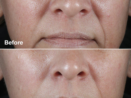 CLINIQUE SMART CLINICAL REPAIR Crème Correctrice Anti-Rides - 50ml